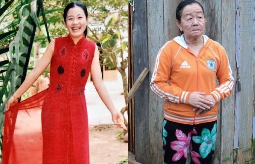 Vietnamese Woman Ages From 23 To 73 In Just Days