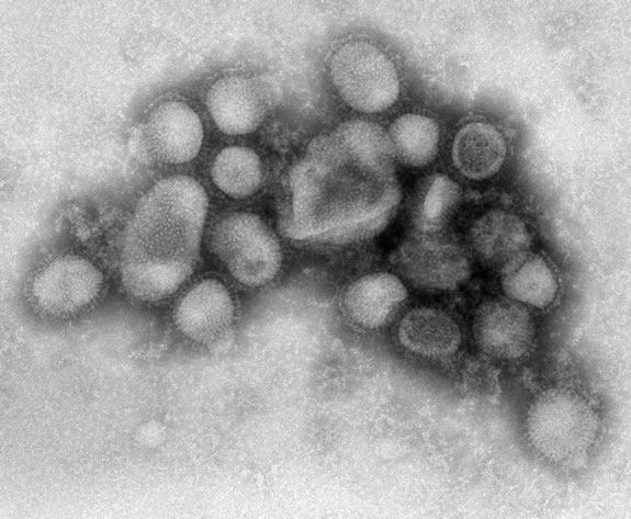 Dutch Scientists Create Highly Contagious Super-Influenza Virus