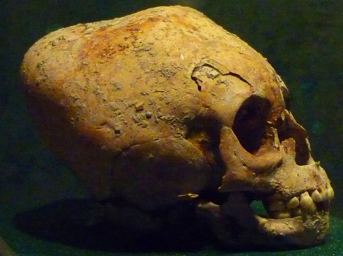 Maya modified skull exhibited at the Museo Nacional de Antropología e Historia, México.